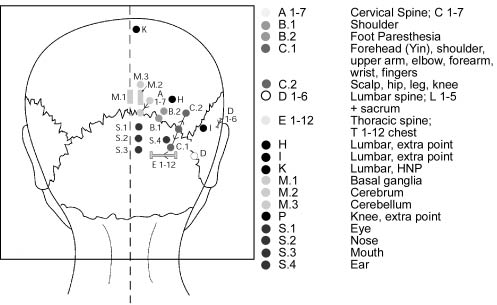 acupuntura cranel YNSA terapia para el tratamiento del dolor