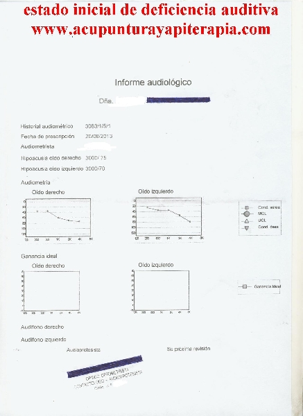 Caso real de mejora auditiva - estado inicial