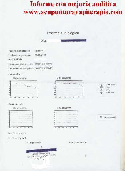 Caso real de mejoría auditiva 